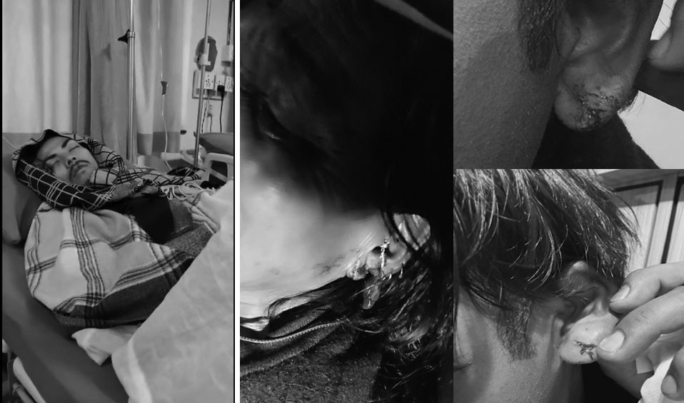 मूलपानीबाट समातिएको समूह : जसले सुन लुट्दा कुटपिट गर्दै कानसमेत चुँडाइदिए