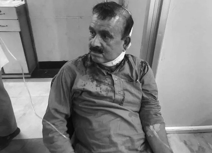 कांग्रेस सहमहामन्त्री महेन्द्र यादवमाथि खुकुरी प्रहार