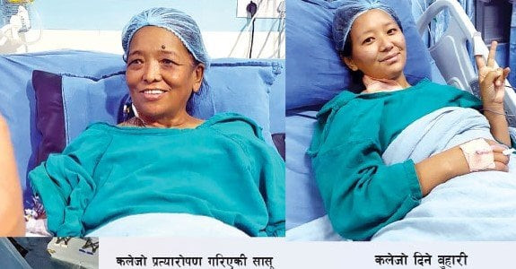 सासूलाई बुहारीको कलेजो दान