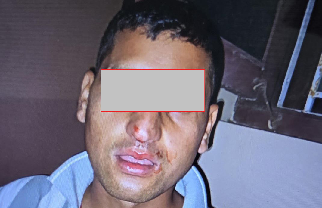 प्रहरी निरीक्षकबिच कुटाकुट