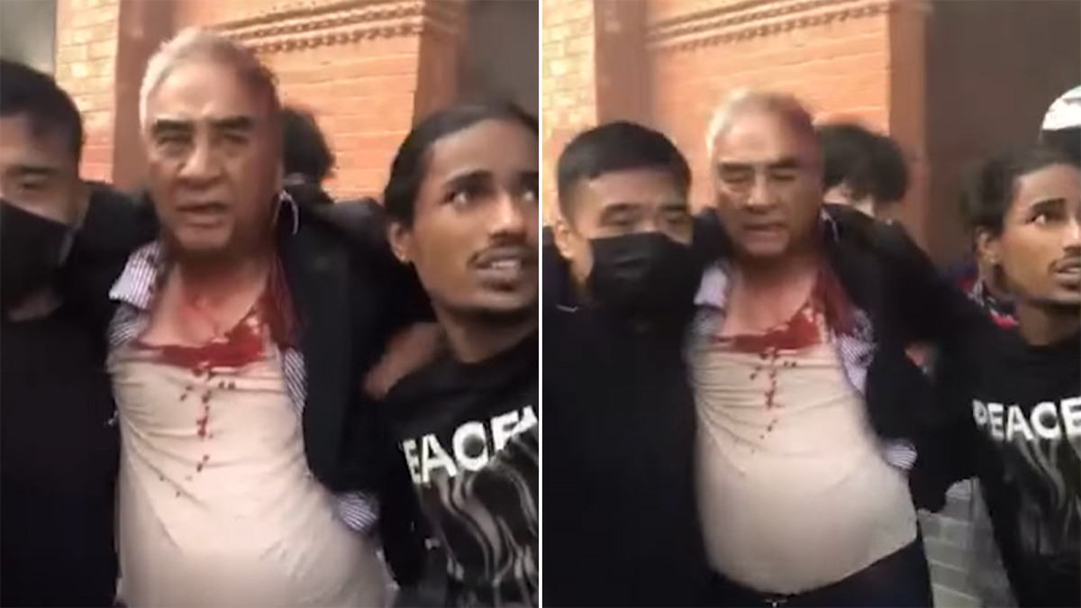 रक्ताम्य हुने गरी कुटिए पूर्वप्रधानमन्त्री देउवा